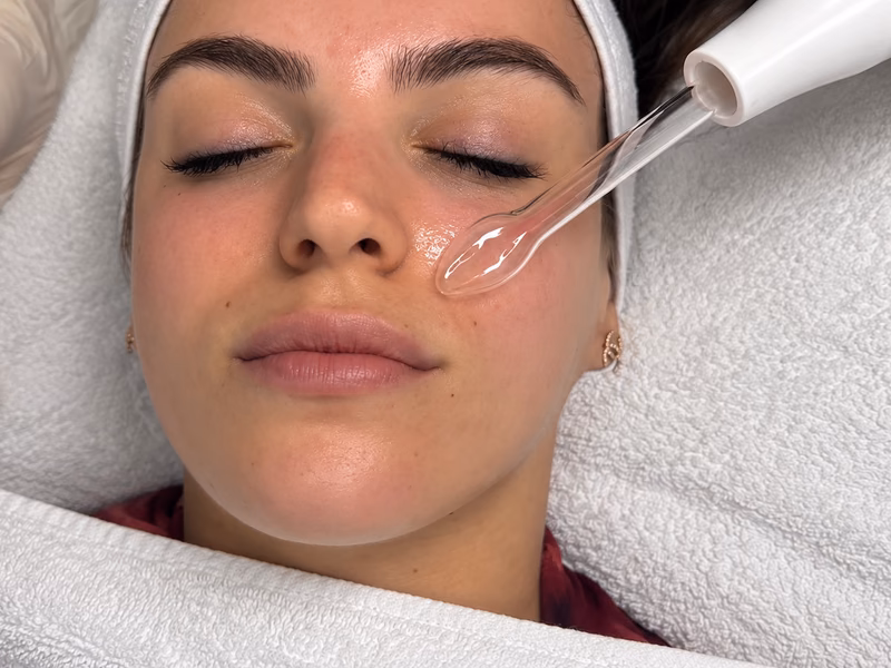 A high-frequency facial wand being used on a client’s cheek
